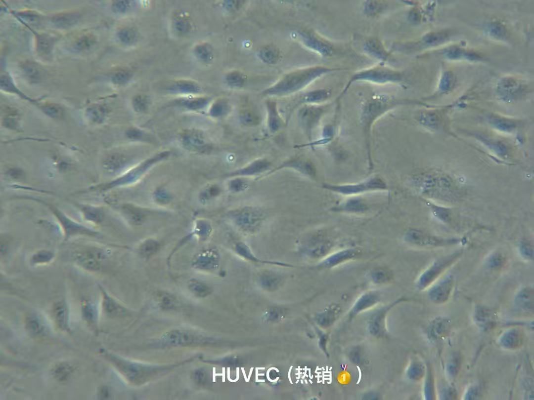 HUVEC/人肥大细胞